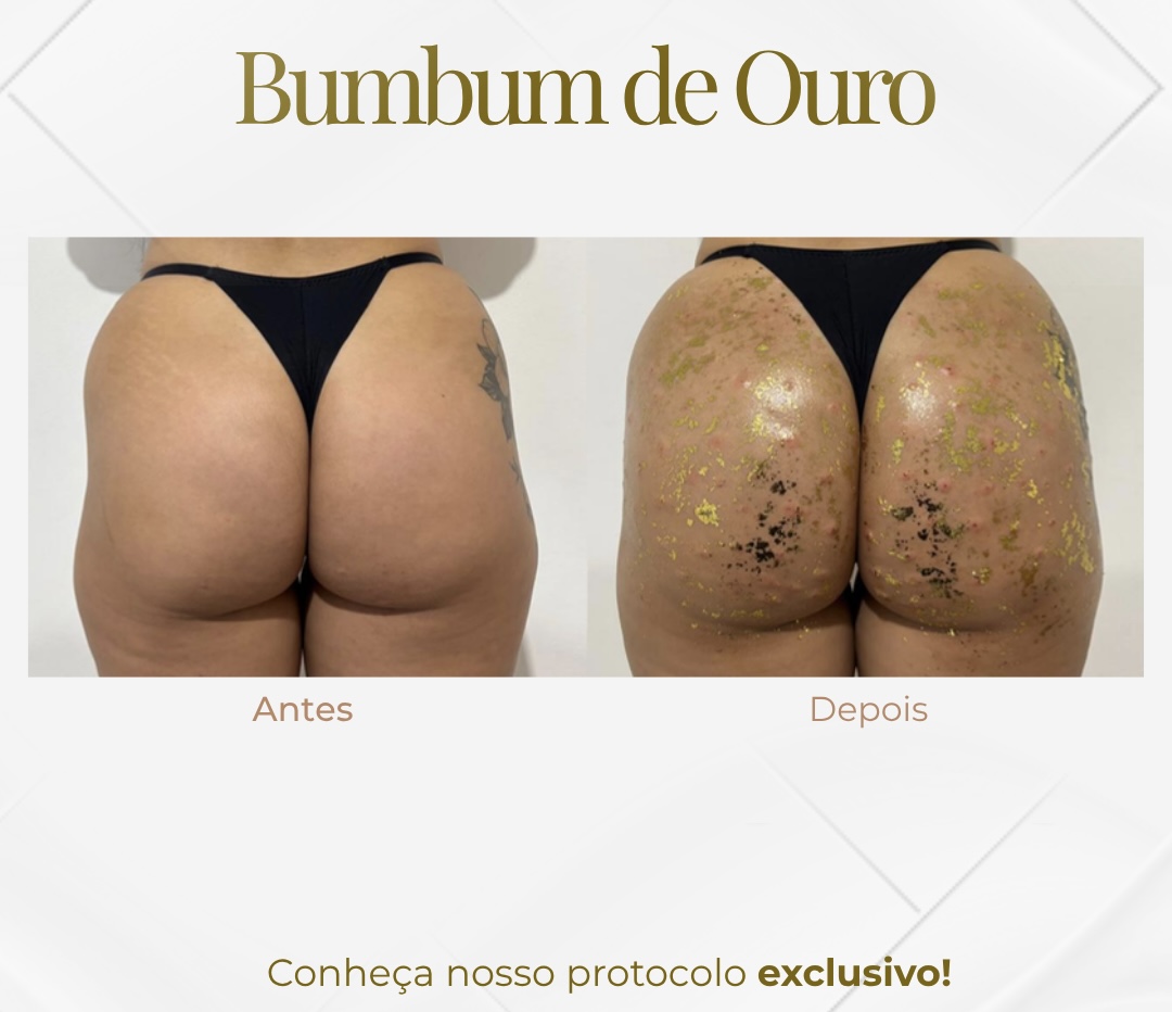 Bumbum de Ouro 24k — Black Shine