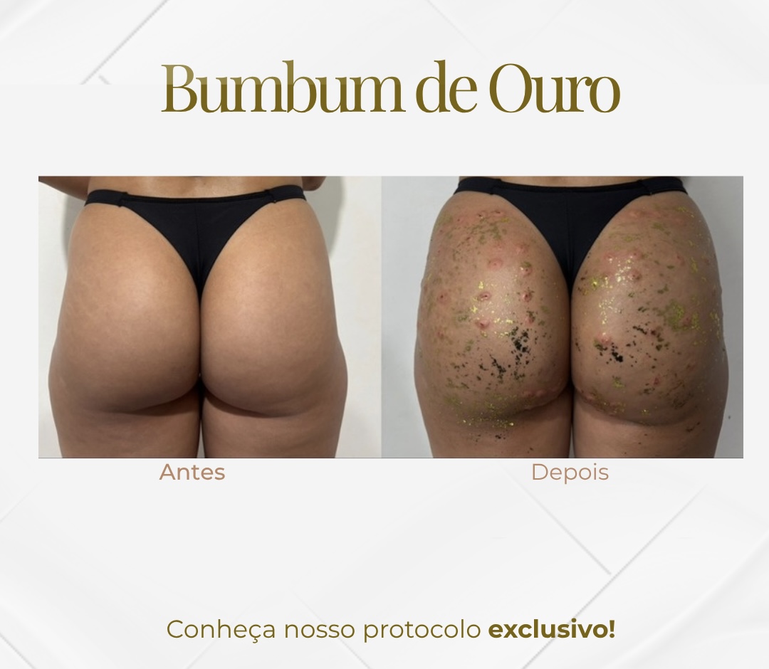 Bumbum de Ouro 24k — Black Shine