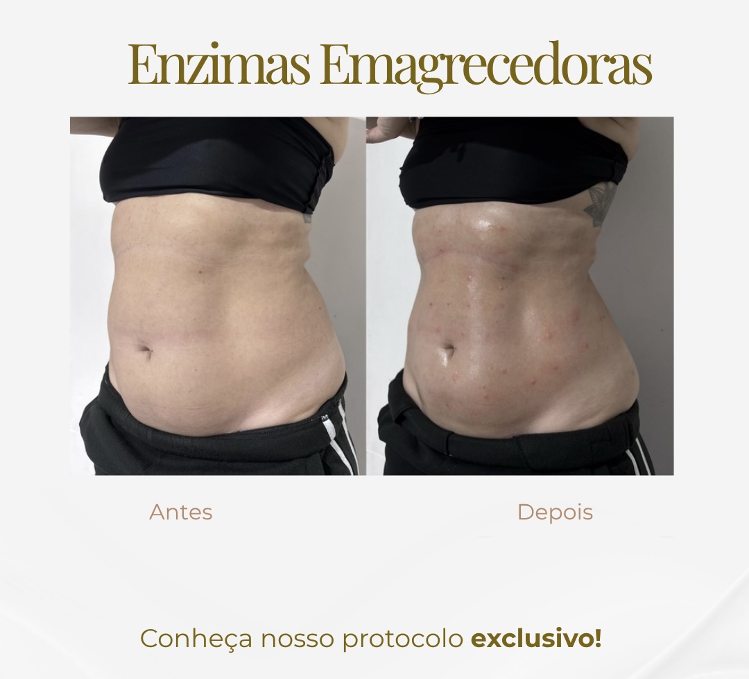 Enzimas Emagrecedoras — Black Shine