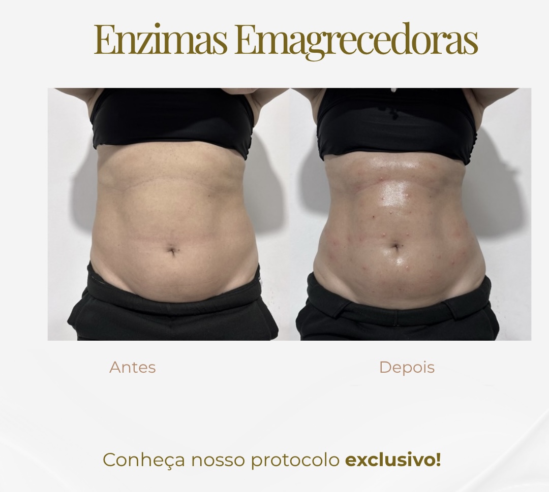 Enzimas Emagrecedoras — Black Shine
