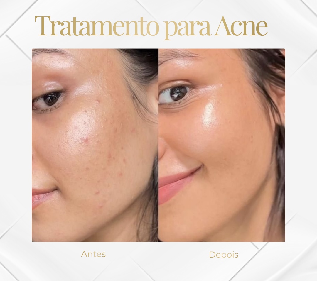 Pele Renovada — Black Shine