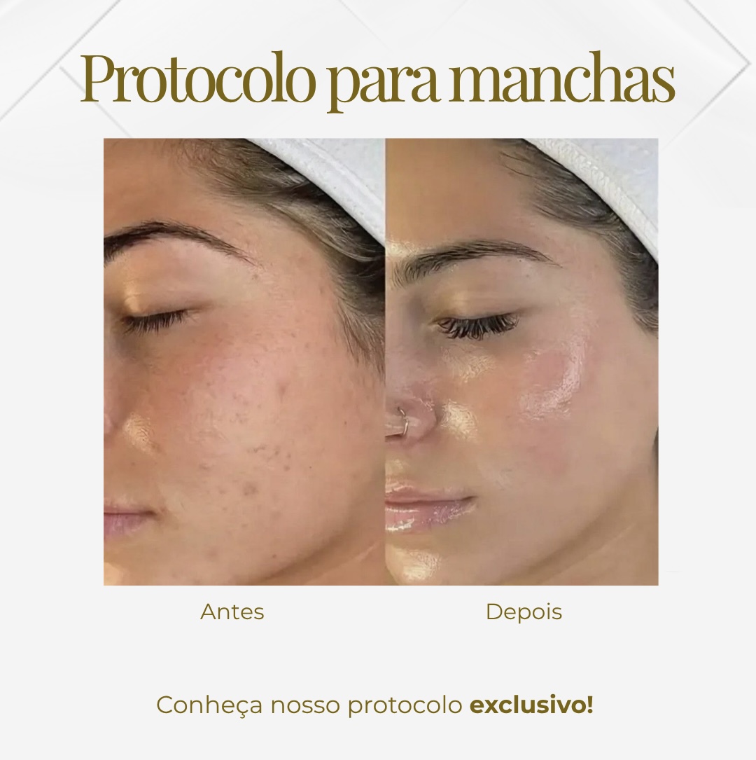 Tratamento de Manchas — Black Shine