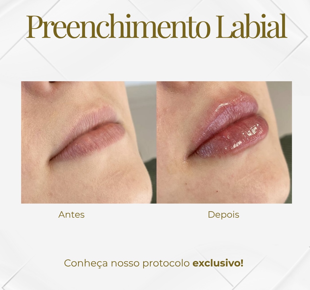 Lábios Naturais — Black Shine